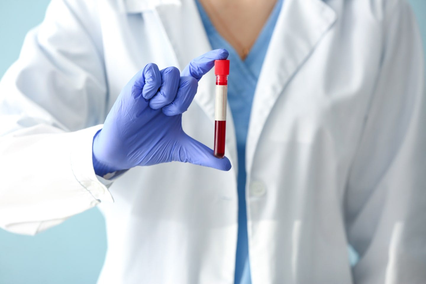 血液検査の項目と数値の意味、疑われる病気