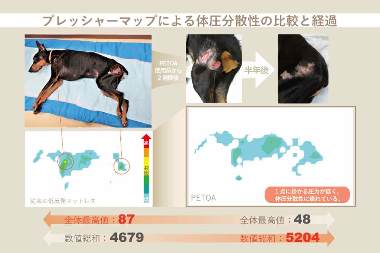 プレッシャーマップによる体圧分散性の比較と経過 プレッシャーマップによる体圧分散性の比較と経過